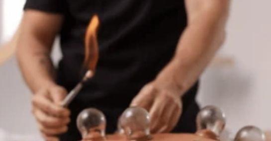 therapie par les ventouses